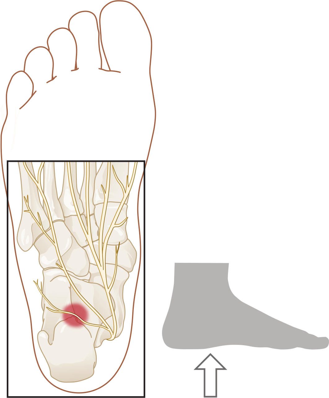 De zenuw van Baxter is een kleine zenuw onder de hiel die een spier bij de kleine teen aanstuurt. De zenuw van Baxter is een kleine zenuw onder de hiel die een spier bij de kleine teen aanstuurt.